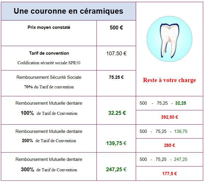 découvrez notre mutuelle implant dentaire qui couvre une large gamme de soins. profitez d'une protection optimale pour vos implants dentaires et accédez à des remboursements avantageux pour garantir votre santé bucco-dentaire.