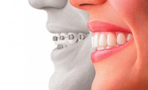 découvrez la mutuelle miel pour l'orthodontie, idéale pour couvrir vos soins dentaires. profitez d'une protection optimale et d'un remboursement avantageux pour vos traitements orthodontiques, tout en bénéficiant d'un service client à l'écoute de vos besoins.