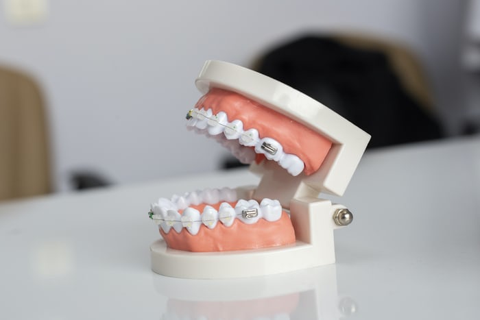 découvrez nos solutions de mutuelle orthodontie pour adultes. profitez d'une couverture adaptée à vos besoins pour des soins orthodontiques de qualité, tout en maîtrisant votre budget. informez-vous sur les garanties, les remboursements et les avantages de notre mutuelle.